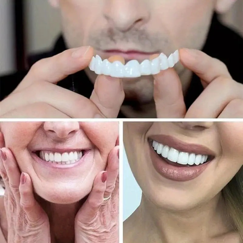 2 Pairs Snap-On Teeth Covers – Natural Look, Instant Smile Upgrade