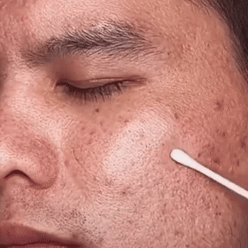 Green Mask Stick Black Head & Acne Remover - 100% Original