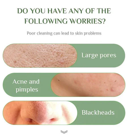 Green Mask Stick Black Head & Acne Remover - 100% Original