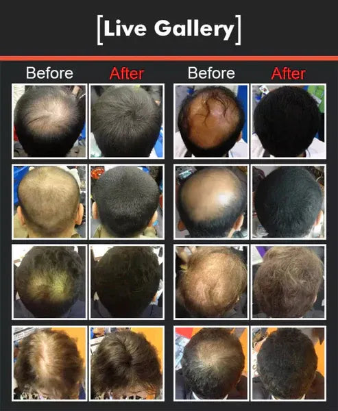 Dexe Hair Building Powder for Men & Women