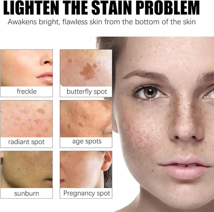 Dark Spot Removal Urea Vitamin E Cream With Free Delivery